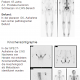 SPECT - klinische Anwendungsbereiche (7)