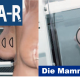 Die Mammographie (Teil 2)