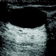 Die Mammographie (Teil 1)