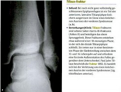 Quelle: Axel St&auml;bler, Birgit Ertl-Wagner "Radiologie Trainer Bewegungsapparat"