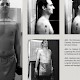 Acromioclaviculargelenke Stressaufnahme